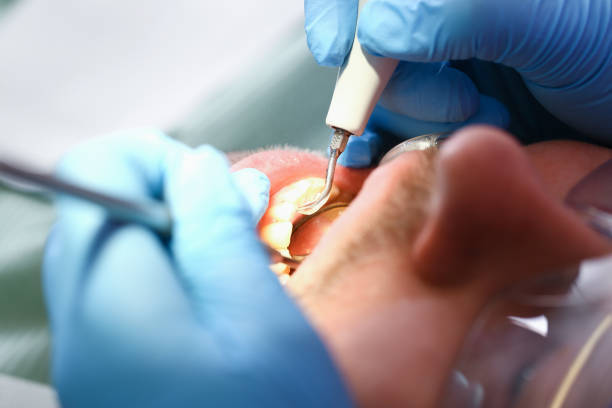 Best Urgent Tooth Repair  in Victory Lakes, NJ